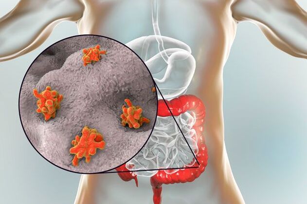 Cineálacha seadáin i gcorp an duine