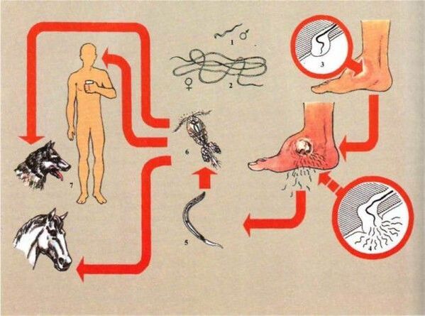 Forbairt dracunculiasis