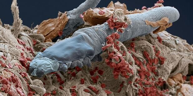 mite demodex
